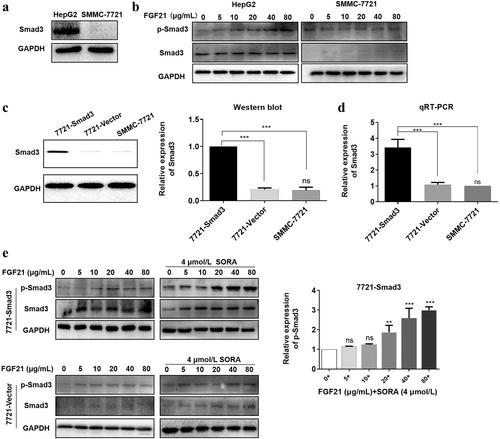 FGF21 increases the sensitivity of hepatocellular carcinoma to sorafenib under hypoxia