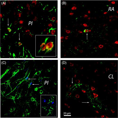 The post-stroke young adult brain has limited capacity to re-express the gene expression patterns seen during early postnatal brain development