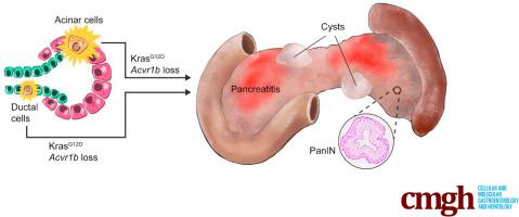 Acvr1b Loss Increases Formation of Pancreatic Precancerous Lesions From Acinar and Ductal Cells of Origin