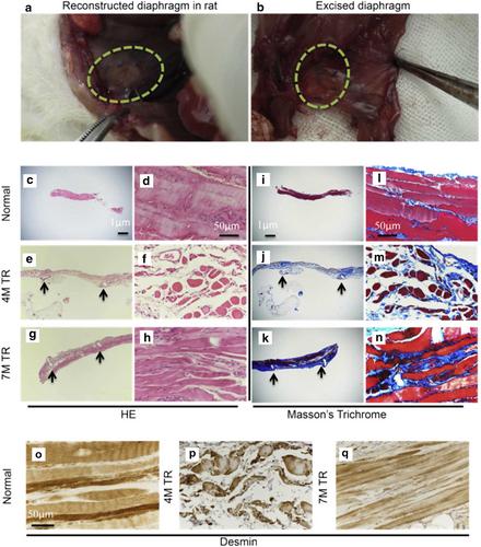 Enhancing diaphragmatic defect repair and regeneration: How biomaterials leading the way to progress?