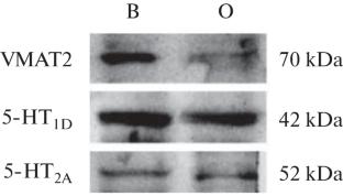 Spatial Organization of the Components of the Serotonergic System in the Early Mouse Development