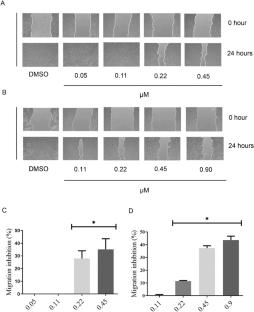 Ruthenium(II) complex with 2-mercaptothiazoline ligand induces selective cytotoxicity involving DNA damage and apoptosis in melanoma cells