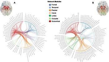 Reduced brain connectivity underlying value-based choices and outcomes in stimulant use disorder