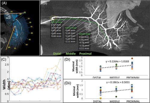 The anatomical pattern of ductal arborization in parotid glands using cone-beam computerized sialography