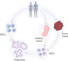 iPSC-derived and Patient-Derived Organoids: Applications and challenges in scalability and reproducibility as pre-clinical models