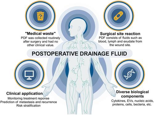 Hidden messages in fluids: A review of clinical and fundamental perspectives on post-lymph node dissection drains