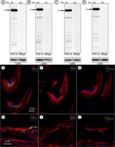 Myosin VI Is Associated With the Endoplasmic Reticulum in Regions of Sertoli Cells Containing Tubulobulbar Complexes