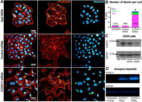The Heterotaxy Gene CCDC11 Is Important for Cytokinesis via RhoA Regulation