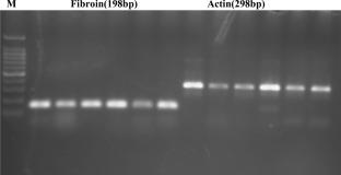 Screening of Economically Sustainable Strains of Bivoltine Silkworm, Bombyx mori L. by Assessing the Comparative Fibroin Gene Expression