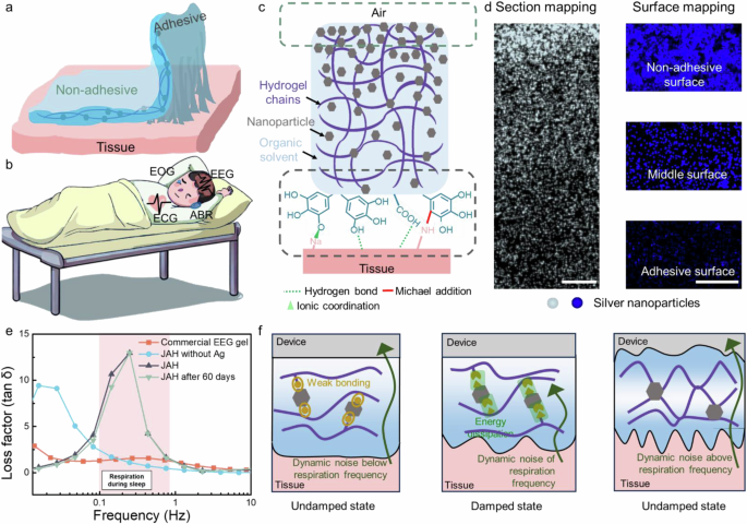 A selective frequency damping and Janus adhesive hydrogel as bioelectronic interfaces for clinical trials