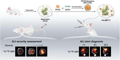 Nanoengineered Neutrophil as <sup>19</sup>F-MRI Tracer for Alert Diagnosis and Severity A of Acute Lung Injury.