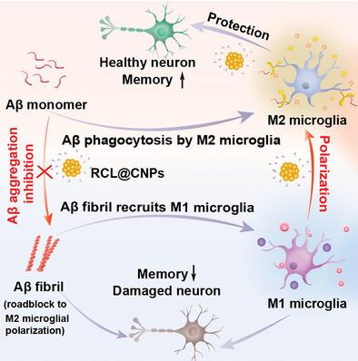 Intranasal Delivery of Pure Nanodrug Loaded Liposomes for Alzheimer's Disease Treatment by Efficiently Regulating Microglial Polarization.