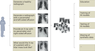 Synthetic chest X-ray images from text prompts