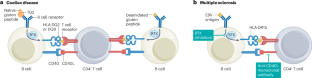 Coeliac disease as a model for understanding multiple sclerosis