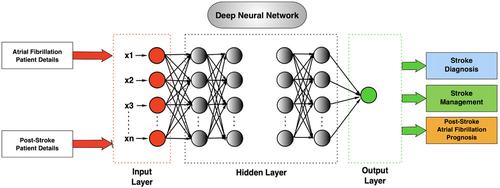 The role of artificial intelligence in optimizing management of atrial fibrillation in acute ischemic stroke