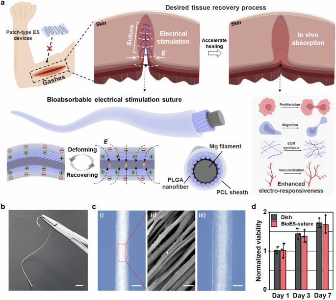 A bioabsorbable mechanoelectric fiber as electrical stimulation suture