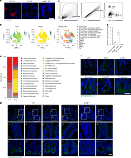 Reply to: LRRK2 is not required for lysozyme expression in Paneth cells