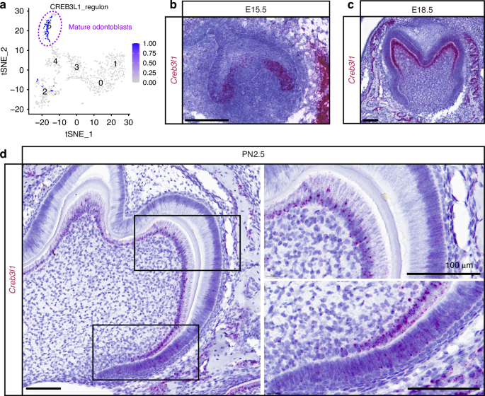 CREB3L1 deficiency impairs odontoblastic differentiation and molar dentin deposition partially through the TMEM30B.