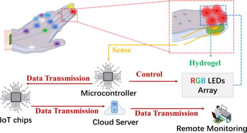 Hydrogel Sensors in an IoT System for Self-Monitoring and Remote Monitoring of Massage Pressure.