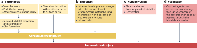 Clinical and subclinical acute brain injury caused by invasive cardiovascular procedures