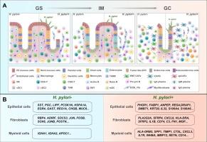 Single-cell transcriptomic profiling uncovers cellular complexity and microenvironment in gastric tumorigenesis associated with Helicobacter pylori