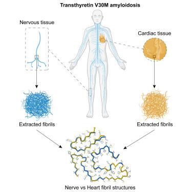 ATTRv-V30M amyloid fibrils from heart and nerves exhibit structural homogeneity