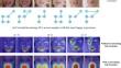 Facial Action Unit Detection by Adaptively Constraining Self-Attention and Causally Deconfounding Sample