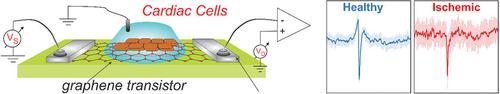 Graphene Field-Effect Transistors toward Study of Cardiac Ischemia at Early Stage