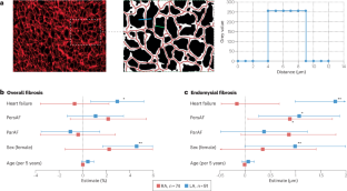 Translation of pathophysiological mechanisms of atrial fibrosis into new diagnostic and therapeutic approaches