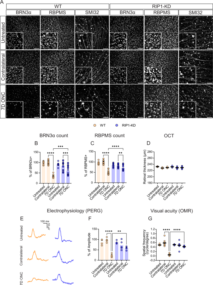 RIP1 inhibition protects retinal ganglion cells in glaucoma models of ocular injury