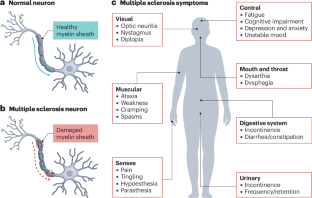 Holding your nerve in academia whilst managing multiple sclerosis