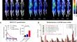 Nuclear imaging of PD-L1 expression promotes the synergistic antitumor efficacy of targeted radionuclide therapy and immune checkpoint blockade