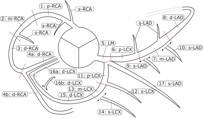 Automated segment-level coronary artery calcium scoring on non-contrast CT: a multi-task deep-learning approach.