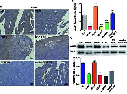 Alarin regulates RyR2 and SERCA2 to improve cardiac function in heart failure with preserved ejection fraction.