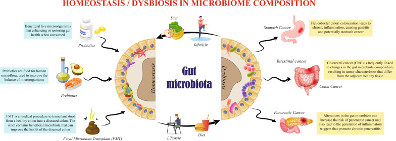 Gastrointestinal cancer resistance to treatment: the role of microbiota.