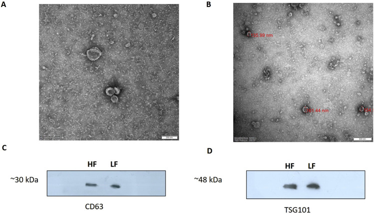 Differential abundance of microRNAs in seminal plasma extracellular vesicles (EVs) in Sahiwal cattle bull related to male fertility.