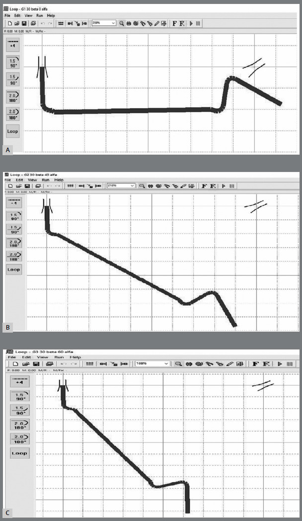 Evaluation of force systems generated by Memory Titanol® springs with different preactivation bends.