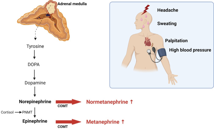 Screening and treatment of endocrine hypertension focusing on adrenal gland disorders: a narrative review.