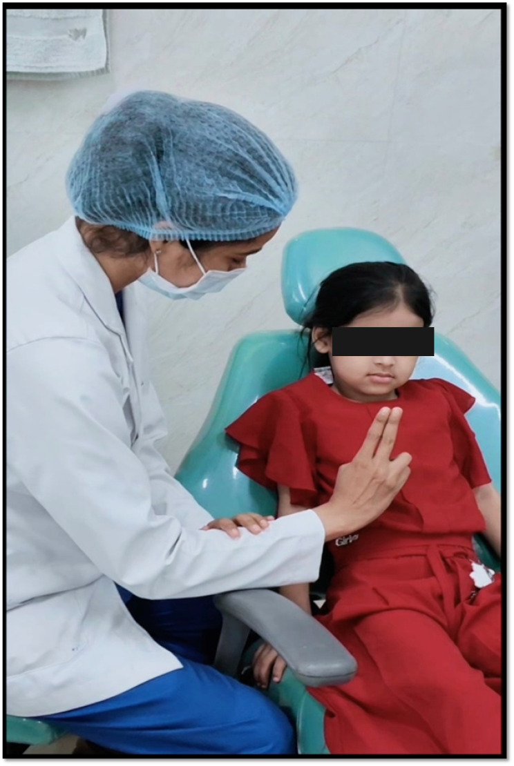 Eye movement desensitization and reprocessing therapy as an adjunct to pain management during dental extraction in children - a randomized control trial.