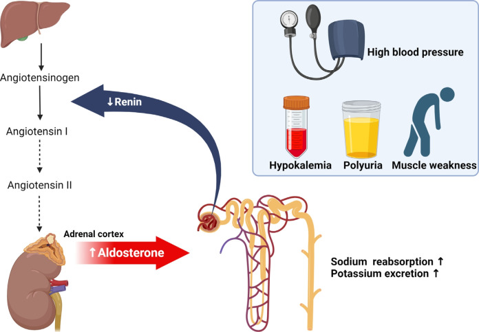 Screening and treatment of endocrine hypertension focusing on adrenal gland disorders: a narrative review.