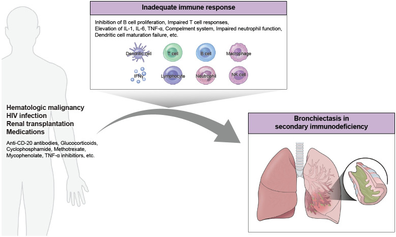 Secondary Immunodeficiency and Non-cystic Fibrosis Bronchiectasis.