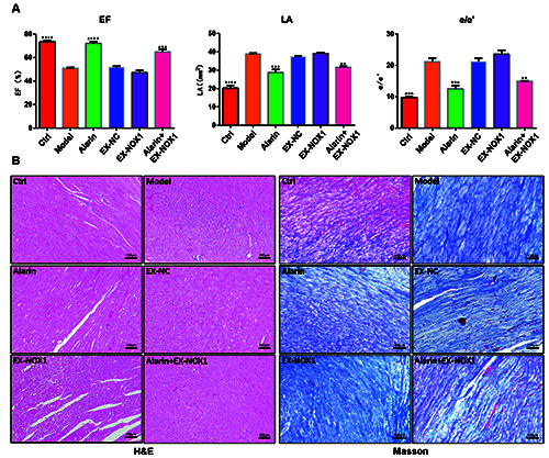 Alarin regulates RyR2 and SERCA2 to improve cardiac function in heart failure with preserved ejection fraction.