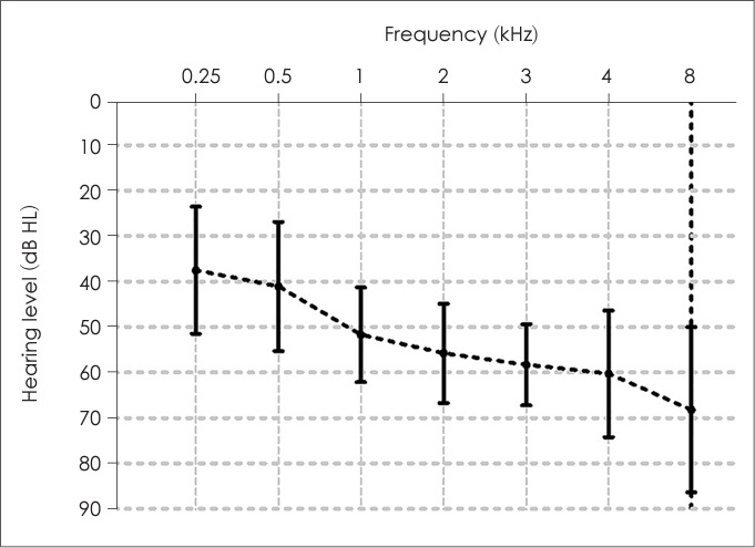 Does Cognitive Function Affect Performance and Listening Effort During Bilateral Wireless Streaming in Hearing Aid Users?