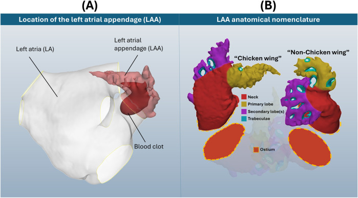 On preserving anatomical detail in statistical shape analysis for clustering: focus on left atrial appendage morphology.