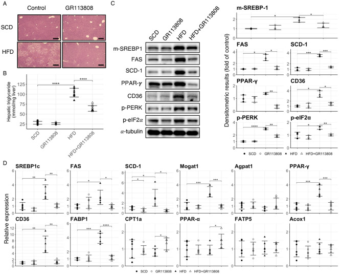 GR113808, a serotonin receptor 4 antagonist, prevents high-fat-diet-induced obesity, fatty liver formation, and insulin resistance in C57BL/6J mice.