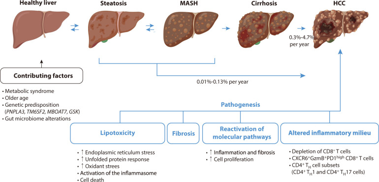 Pathogenesis and management of metabolic dysfunction-associated steatohepatitis-related hepatocellular carcinoma: a narrative review.
