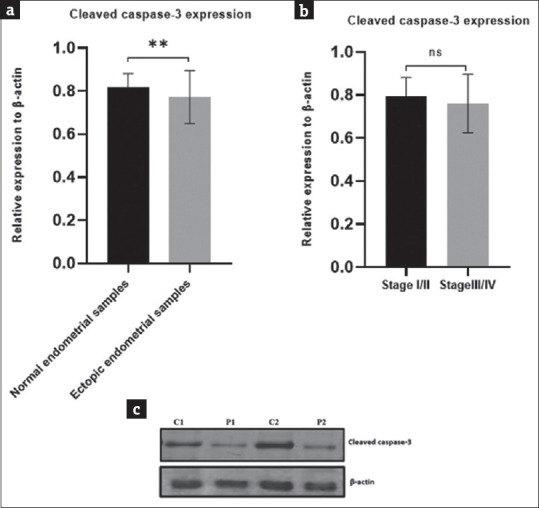 Modulation of Long Non-coding RNA FAS-AS1/FAS/Caspase3 Axis in Endometriosis: A Cross-sectional Study.
