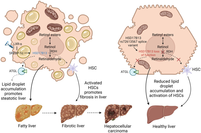 Decoding 17-Beta-hydroxysteroid Dehydrogenase 13: A Multifaceted Perspective on Its Role in Hepatic Steatosis and Associated Disorders.