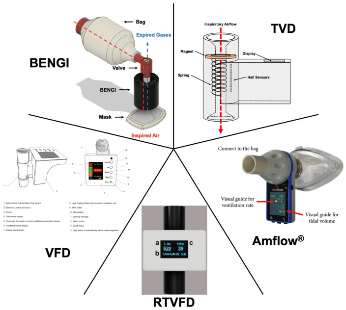 Pathophysiology and Prevention of Manual-Ventilation-Induced Lung Injury (MVILI).