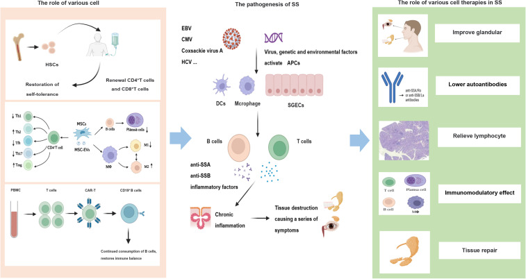 Cell therapy in Sjögren's syndrome: opportunities and challenges.